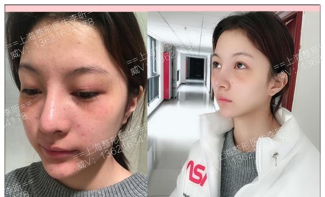 美颜相机如何调整左右脸对称？调整后效果如何？
